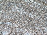 CLPP Antibody in Immunohistochemistry (Paraffin) (IHC (P))