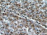 CLPP Antibody in Immunohistochemistry (Paraffin) (IHC (P))