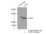 CLPP Antibody in Immunoprecipitation (IP)