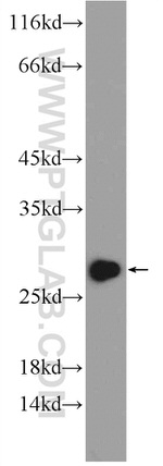 CLPP Antibody in Western Blot (WB)