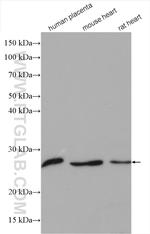 CLPP Antibody in Western Blot (WB)