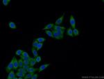 IGFBP2 Antibody in Immunocytochemistry (ICC/IF)