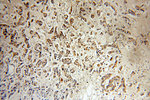 IGFBP2 Antibody in Immunohistochemistry (Paraffin) (IHC (P))