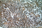 IGFBP2 Antibody in Immunohistochemistry (Paraffin) (IHC (P))