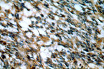 IGFBP2 Antibody in Immunohistochemistry (Paraffin) (IHC (P))