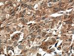 IGFBP2 Antibody in Immunohistochemistry (Paraffin) (IHC (P))