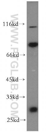 IGFBP2 Antibody in Western Blot (WB)