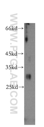 IGFBP2 Antibody in Western Blot (WB)