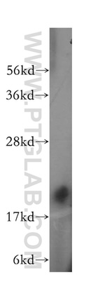 HSPB7 Antibody in Western Blot (WB)