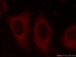 EIF4G1 Antibody in Immunocytochemistry (ICC/IF)