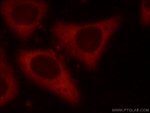 EIF4G1 Antibody in Immunocytochemistry (ICC/IF)