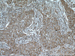 EIF4G1 Antibody in Immunohistochemistry (Paraffin) (IHC (P))