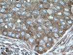 EIF4G1 Antibody in Immunohistochemistry (Paraffin) (IHC (P))