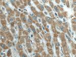 L2HGDH Antibody in Immunohistochemistry (Paraffin) (IHC (P))