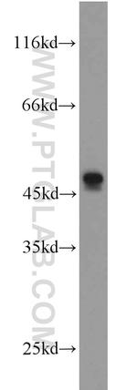L2HGDH Antibody in Western Blot (WB)