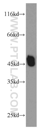 L2HGDH Antibody in Western Blot (WB)