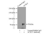 ACSL5 Antibody in Immunoprecipitation (IP)