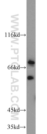 ACSL5 Antibody in Western Blot (WB)