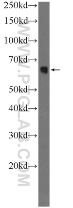 ACSL5 Antibody in Western Blot (WB)