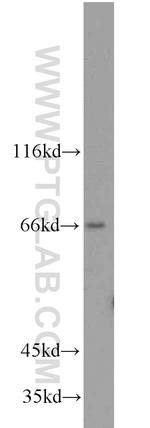 ACSL5 Antibody in Western Blot (WB)