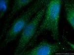 GSS Antibody in Immunocytochemistry (ICC/IF)