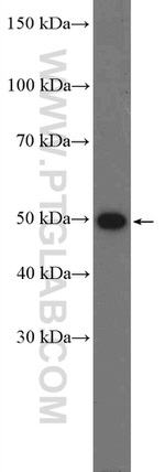 GSS Antibody in Western Blot (WB)