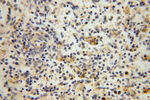 NARS2 Antibody in Immunohistochemistry (Paraffin) (IHC (P))
