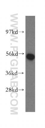 NARS2 Antibody in Western Blot (WB)