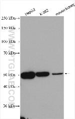 NARS2 Antibody in Western Blot (WB)