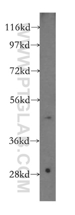 NARS2 Antibody in Western Blot (WB)