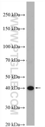 BCKDK Antibody in Western Blot (WB)