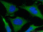 SNX9 Antibody in Immunocytochemistry (ICC/IF)