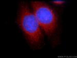 SNX9 Antibody in Immunocytochemistry (ICC/IF)