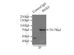 SNX9 Antibody in Immunoprecipitation (IP)