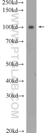 AP2A2 Antibody in Western Blot (WB)