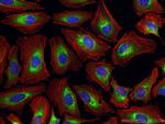 CRTAP Antibody in Immunocytochemistry (ICC/IF)