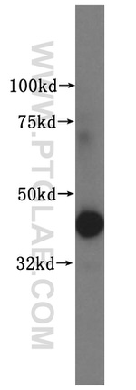 CRTAP Antibody in Western Blot (WB)