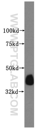 CRTAP Antibody in Western Blot (WB)