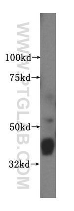 CRTAP Antibody in Western Blot (WB)