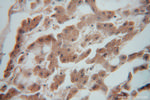 NDUFS7 Antibody in Immunohistochemistry (Paraffin) (IHC (P))