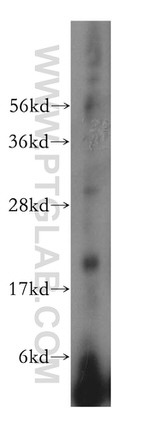 NDUFS7 Antibody in Western Blot (WB)
