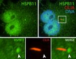 IFT25 Antibody in Immunocytochemistry (ICC/IF)