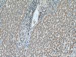 DHRS2 Antibody in Immunohistochemistry (Paraffin) (IHC (P))