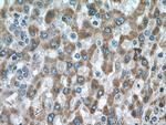 DHRS2 Antibody in Immunohistochemistry (Paraffin) (IHC (P))