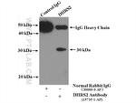 DHRS2 Antibody in Immunoprecipitation (IP)