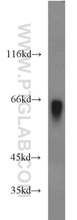 Hemopexin Antibody in Western Blot (WB)