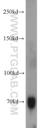 Hemopexin Antibody in Western Blot (WB)