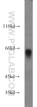 Hemopexin Antibody in Western Blot (WB)