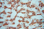 TRIM14 Antibody in Immunohistochemistry (Paraffin) (IHC (P))