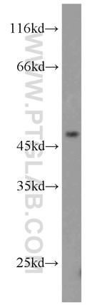 TRIM14 Antibody in Western Blot (WB)